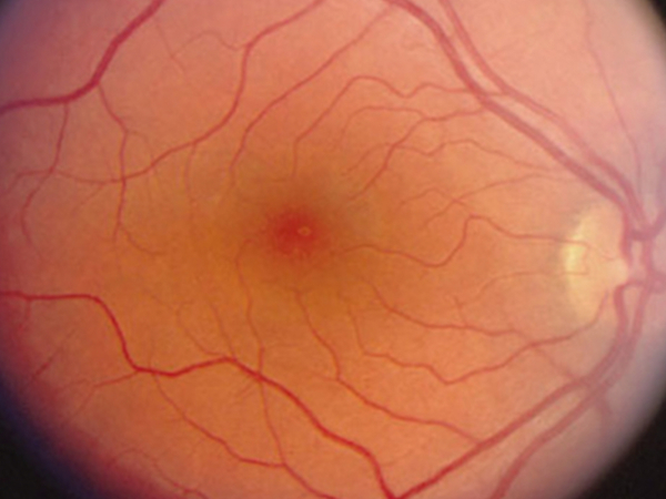 la macula è la parte centrale della retina